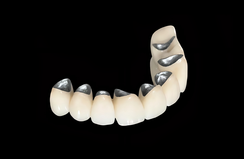 Precious White Metal Crown